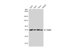 Invitrogen PAK6 Polyclonal Antibody 100 &mu;L; Unconjugated:Antibodies,