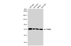 Invitrogen PAK6 Polyclonal Antibody 100 &mu;L; Unconjugated:Antibodies,