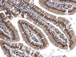 Invitrogen hnRNP A2B1 Polyclonal Antibody 100 &mu;L; Unconjugated:Antibodies,