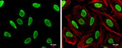 Invitrogen hnRNP A2B1 Polyclonal Antibody 100 &mu;L; Unconjugated:Antibodies,