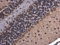 Invitrogen hnRNP A2B1 Polyclonal Antibody 100 &mu;L; Unconjugated:Antibodies,