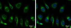 Invitrogen GRP78 Polyclonal Antibody 100 &mu;L; Unconjugated:Antibodies,