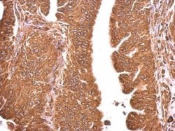 Invitrogen GRP78 Polyclonal Antibody 100 &mu;L; Unconjugated:Antibodies,