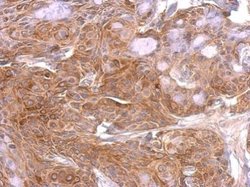 Invitrogen GAP43 Polyclonal Antibody 100 &mu;L; Unconjugated:Antibodies,