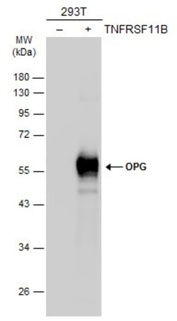Invitrogen TNFRSF11B Polyclonal Antibody 100 &mu;L; Unconjugated:Antibodies,