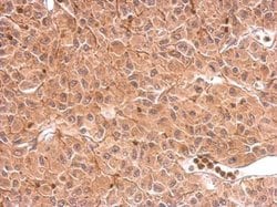 Invitrogen DCTD Polyclonal Antibody 100 &mu;L; Unconjugated:Antibodies,