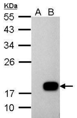 Invitrogen DCTD Polyclonal Antibody 100 &mu;L; Unconjugated:Antibodies,