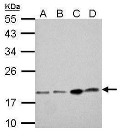 Invitrogen DCTD Polyclonal Antibody 100 &mu;L; Unconjugated:Antibodies,