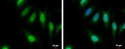 Invitrogen CFDP1 Polyclonal Antibody 100 &mu;L; Unconjugated:Antibodies,