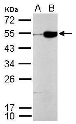 Invitrogen CFDP1 Polyclonal Antibody 100 &mu;L; Unconjugated:Antibodies,