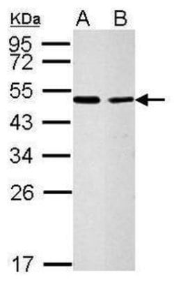 Invitrogen CFDP1 Polyclonal Antibody 100 &mu;L; Unconjugated:Antibodies,