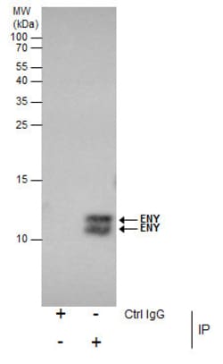 Invitrogen ENY2 Polyclonal Antibody 100 &mu;L | Buy Online | Invitrogen&trade; | Fisher Scientific