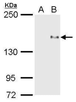 Invitrogen PREX1 Polyclonal Antibody 100 &mu;L | Buy Online | Invitrogen&trade; | Fisher Scientific