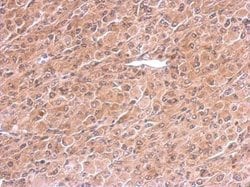 Invitrogen PREX1 Polyclonal Antibody 100 &mu;L | Buy Online | Invitrogen&trade; | Fisher Scientific