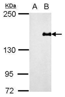 Invitrogen PREX1 Polyclonal Antibody 100 &mu;L | Buy Online | Invitrogen&trade; | Fisher Scientific