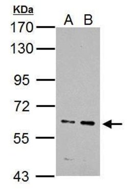 Invitrogen IKZF4 Polyclonal Antibody 100 &mu;L; Unconjugated:Antibodies,