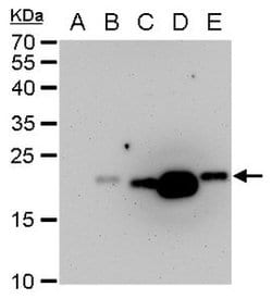 Invitrogen&trade;&nbsp;Dengue Virus Type 2 PrM Polyclonal Antibody