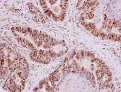 Invitrogen EHMT2 Polyclonal Antibody 100 &mu;L; Unconjugated:Antibodies,