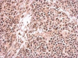 Invitrogen EHMT2 Polyclonal Antibody 100 &mu;L; Unconjugated:Antibodies,