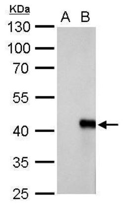 Invitrogen WIPI1 Polyclonal Antibody 100 μL; Unconjugated:Antibodies,
