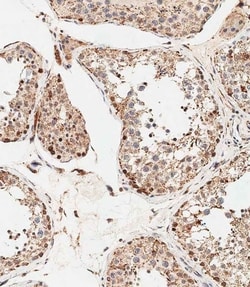 Invitrogen STRA8 Polyclonal Antibody 400 &mu;L; Unconjugated:Antibodies,