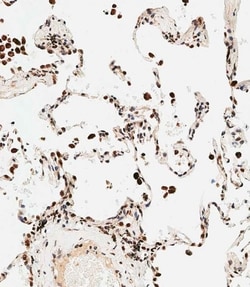 Invitrogen STRA8 Polyclonal Antibody 400 &mu;L; Unconjugated:Antibodies,