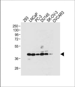 Invitrogen STRA8 Polyclonal Antibody 400 &mu;L; Unconjugated:Antibodies,