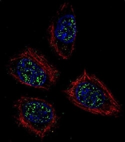 Invitrogen PNN Polyclonal Antibody 400 &mu;L; Unconjugated:Antibodies,