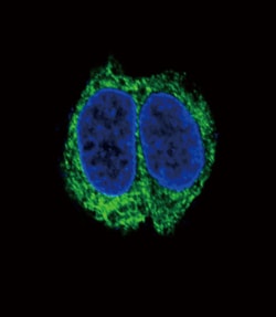 Invitrogen TGFBR2 Polyclonal Antibody 400 &mu;L; Unconjugated:Antibodies,