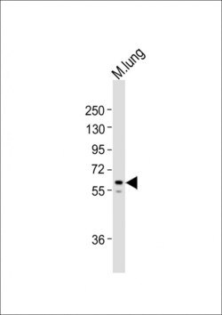 Invitrogen TGFBR2 Polyclonal Antibody 400 &mu;L; Unconjugated:Antibodies,