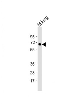 Invitrogen TGFBR2 Polyclonal Antibody 400 &mu;L; Unconjugated:Antibodies,