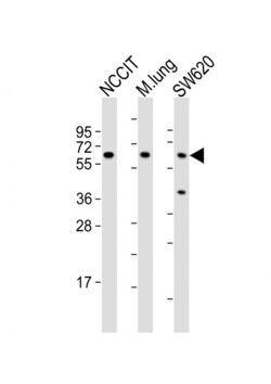 Invitrogen TGFBR2 Polyclonal Antibody 400 &mu;L; Unconjugated:Antibodies,