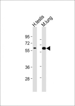 Invitrogen TGFBR2 Polyclonal Antibody 400 &mu;L; Unconjugated:Antibodies,