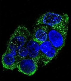 Invitrogen&trade;&nbsp;COL8A2 Polyclonal Antibody