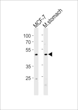 Invitrogen FOXA2 Polyclonal Antibody 400 &mu;L; Unconjugated:Antibodies,