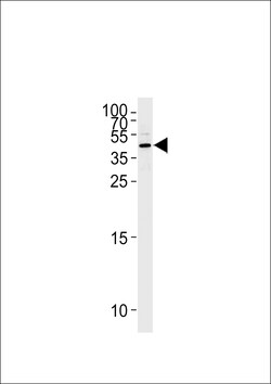 Invitrogen Maspin Polyclonal Antibody 400 &mu;L; Unconjugated:Antibodies,