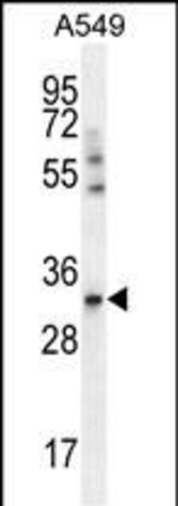 Invitrogen SLC25A6 Polyclonal Antibody 400 &mu;L; Unconjugated:Antibodies,