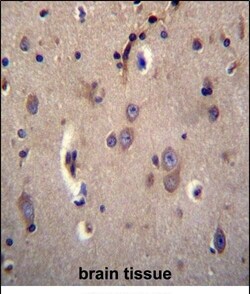 Invitrogen DTNA Polyclonal Antibody 400 &mu;L | Buy Online | Invitrogen&trade; | Fisher Scientific