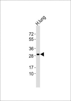 Invitrogen GSTT1 Polyclonal Antibody 400 &mu;L; Unconjugated:Antibodies,