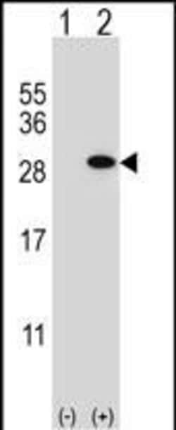 Invitrogen GSTT1 Polyclonal Antibody 400 &mu;L; Unconjugated:Antibodies,