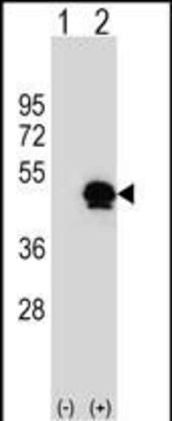 Invitrogen PAI1 Polyclonal Antibody 400 &mu;L; Unconjugated:Antibodies,