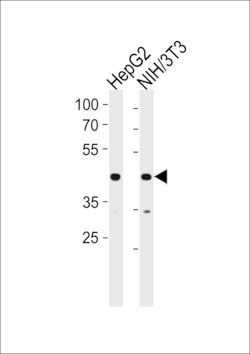 Invitrogen NR2F2 Polyclonal Antibody 400 &mu;L | Buy Online | Invitrogen&trade; | Fisher Scientific