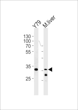 Invitrogen ZONAB Polyclonal Antibody 400 &mu;L; Unconjugated:Antibodies,