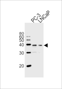 Invitrogen VDR Polyclonal Antibody 400 &mu;L; Unconjugated:Antibodies,