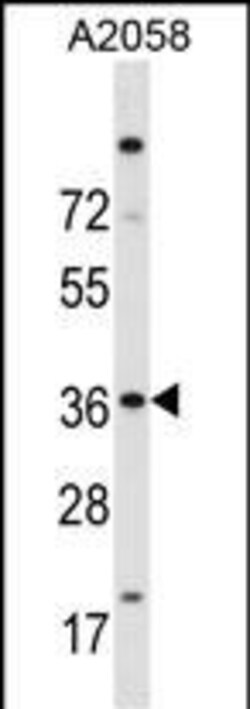 Invitrogen ISL2 Polyclonal Antibody 400 &mu;L; Unconjugated:Antibodies,