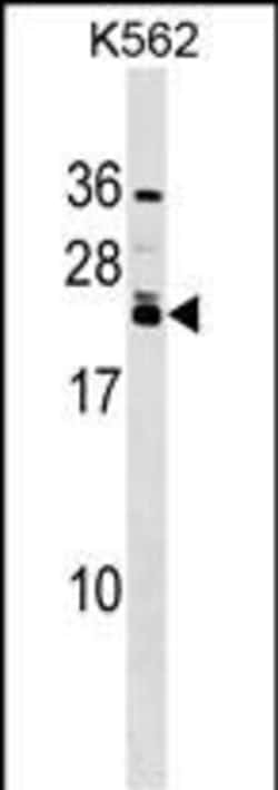 Invitrogen HAND2 Polyclonal Antibody 400 &mu;L; Unconjugated:Antibodies,