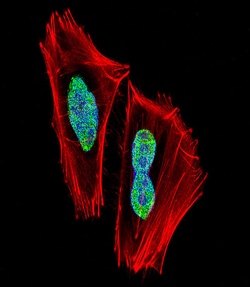 Invitrogen RBPJ Polyclonal Antibody 400 μL; Unconjugated:Antibodies,