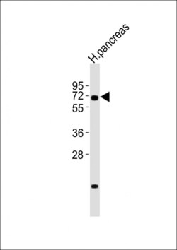 Invitrogen RBPJ Polyclonal Antibody 400 μL; Unconjugated:Antibodies,