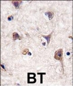Invitrogen LC3A Polyclonal Antibody 400 &mu;L; Unconjugated:Antibodies,