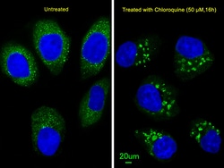 Invitrogen LC3B Polyclonal Antibody 200 &mu;L; Unconjugated:Antibodies,